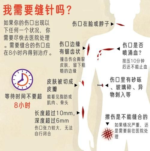 伤口深怎么处理_伤口深需要缝针吗