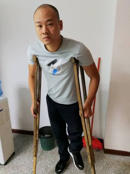 腿残废的词语有哪些_如何准确描述腿部残疾