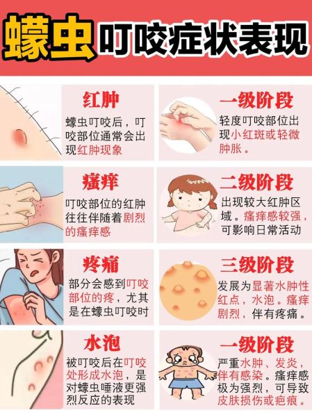 什么虫子会咬人_被虫子咬了怎么办