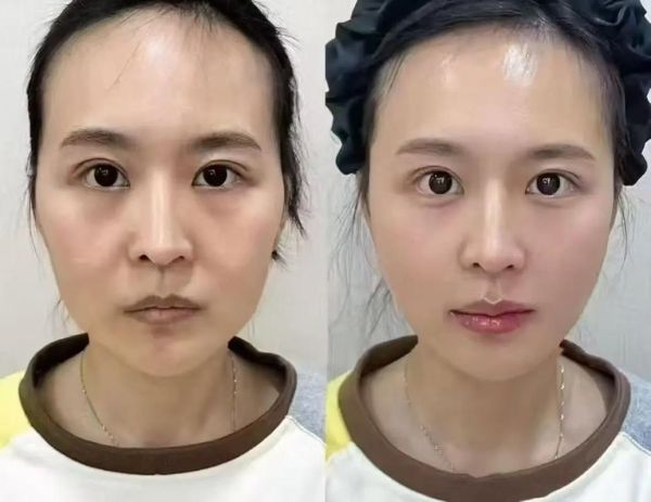 孩子脸蛋像什么_怎么形容更生动