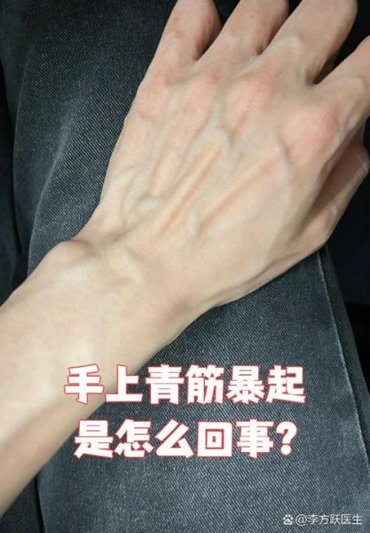 青筋爆出是什么原因_青筋爆出怎么缓解