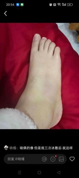 梦到脚崴了_周公解梦准不准