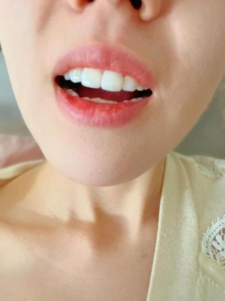 门牙有缝真的破财吗_门牙缝隙大财运差怎么办