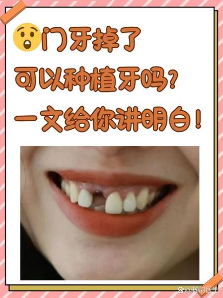 门牙掉了会影响财运吗_门牙掉了怎么转运