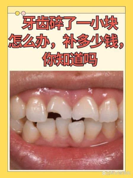 梦到牙齿碎了_牙齿碎了预示什么