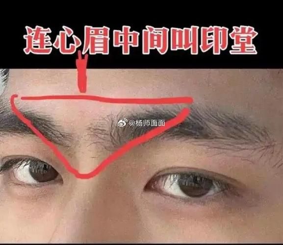 眉心受伤影响运势吗_眉心有疤会改命吗