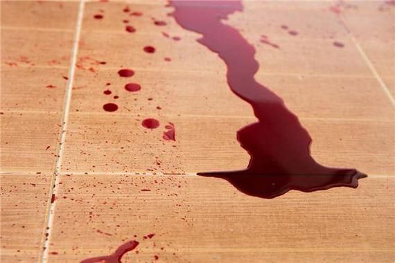 梦到别人被砍_预示什么