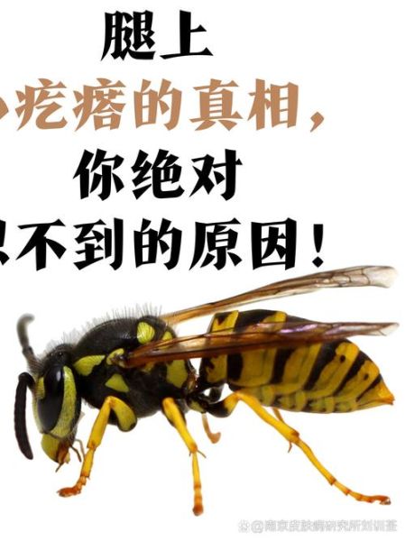 梦到蜜蜂是什么意思_梦到蜜蜂被蛰代表什么