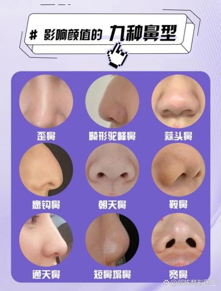 鼻子歪影响财运吗_鼻子歪怎么改运