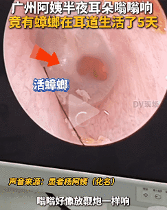 梦到虫子钻进身体_梦里有异物钻入身体预示什么