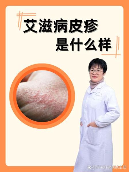 梦到艾滋病是什么意思_梦到艾滋病是吉兆吗