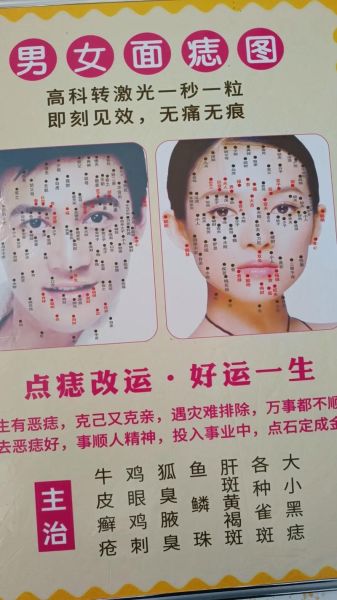 痣的位置与财运真的有关吗_如何通过痣相判断财富运势