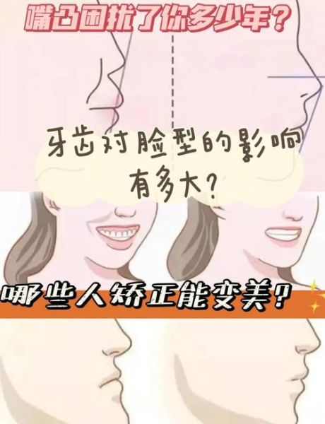 龅牙会影响财运吗_如何化解龅牙带来的破财