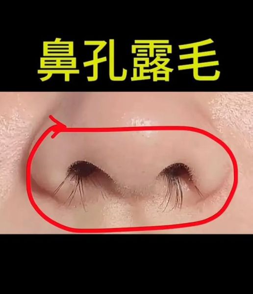 梦到鼻毛是什么意思_梦到鼻毛拔不完怎么办