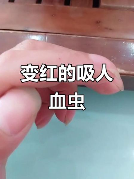 梦到被虫子吸血_意味着什么