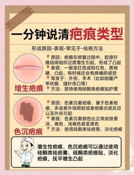 疤痕影响运势吗_如何化解疤痕带来的霉运