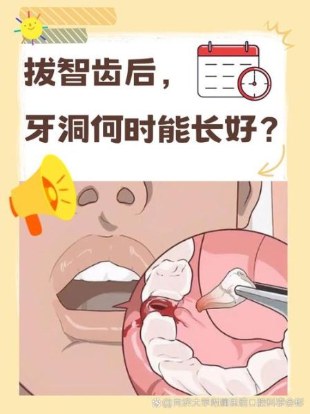 长智齿会影响运势吗_智齿拔除后运气会变好吗