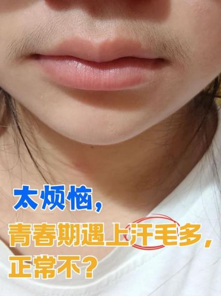 梦到汗毛_梦见汗毛很长是什么意思