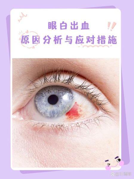 梦见眼睛流血是什么意思_眼睛流血梦境解析
