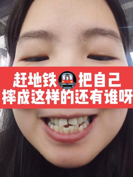 门牙断了影响运势吗_门牙断了风水说法