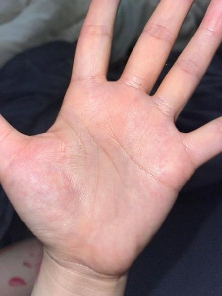 鸭嘴掌纹财运怎么看_鸭嘴掌纹真的准吗