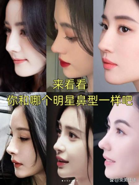 驼峰鼻面相财运_驼峰鼻的人财运好吗