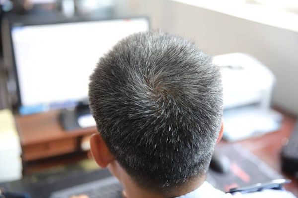 梦到满头白发是什么意思_白发梦境解析