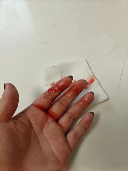 梦到手指被扎破流血_是什么意思