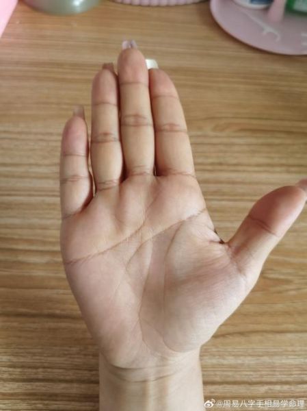 财运线有伤好吗_财运线有伤会影响财运吗