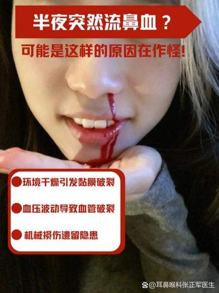 梦到自己流鼻血不止_是什么意思