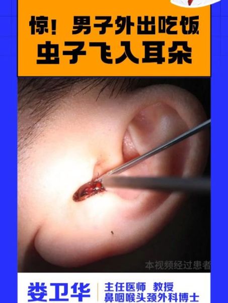 梦到耳朵里拽出虫子_意味着什么