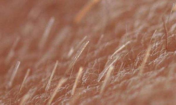 梦到阴毛是什么意思_梦见阴毛脱落预示什么