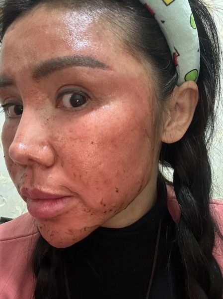 梦到烂脸是什么意思_梦见脸溃烂预示什么