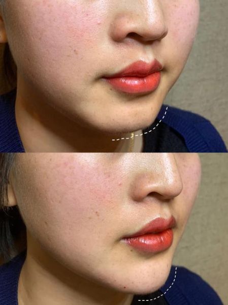 下巴勾财运_下巴形状真的影响财富吗