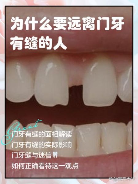 男人门牙有缝影响财运吗_门牙不齐如何转运招财