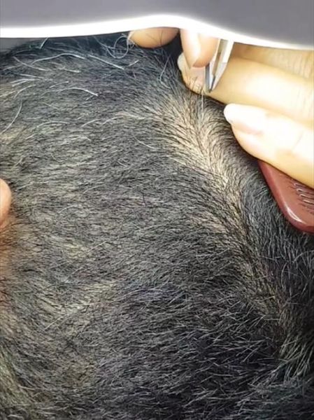 拔白发运势会变差吗_拔白发真的影响运气吗