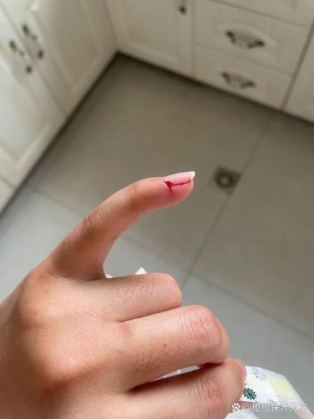 梦到手指被割破是什么意思_梦见手指流血怎么办