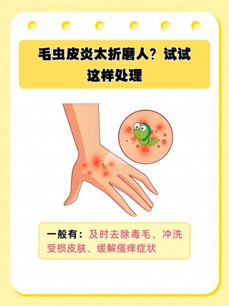 梦到被毛毛虫咬_预示什么