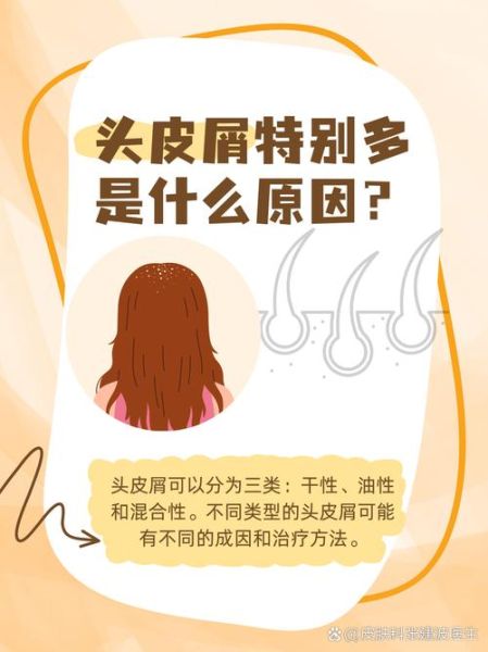 梦见头皮屑是什么预兆_头皮屑梦境解析